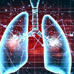 市中肺炎、12％が「不適切な診断」