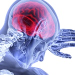 超急性期脳卒中、救急車内での降圧治療は有効か？／NEJM