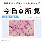 診断名は？【1日1症例のビジュアル診断クイズ】