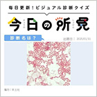 診断名は？【1日1症例のビジュアル診断クイズ】